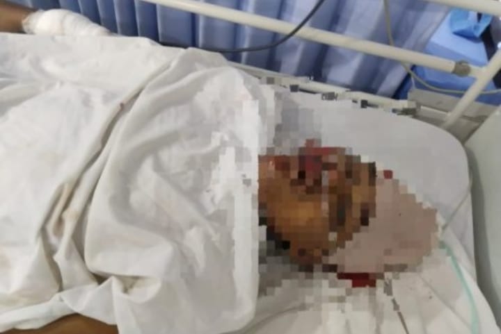 Tawuran Antar Pemuda Di Tebingtinggi, Seorang Remaja Warga Kabupaten Serdang Bedagai Meninggal Dunia 7 Tawuran Antar Pemuda Di Tebingtinggi, Seorang Remaja Warga Kabupaten Serdang Bedagai Meninggal Dunia - IMG 20250919 WA0007